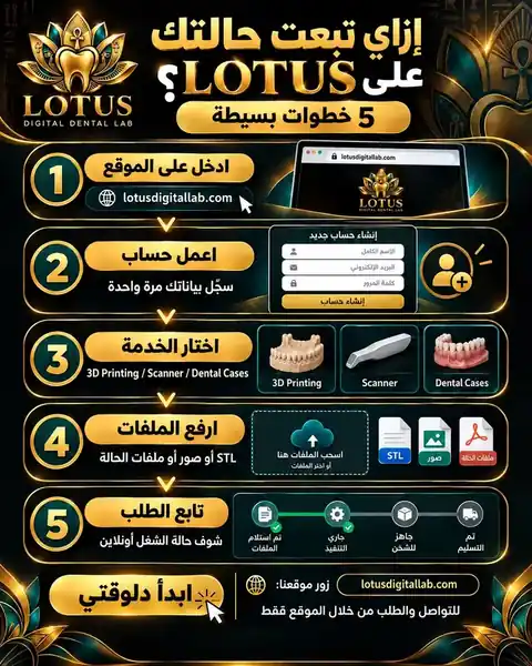 خطوات إرسال حالتك على LOTUS في 5 خطوات